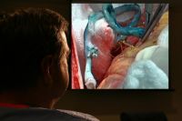 Surgeon showing me a picture of a bypass graft