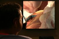 Surgeon showing me a picture of a bypass graft