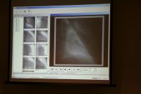 My cardiac cath film