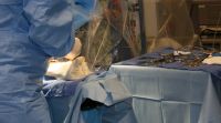 Harvesting an artery